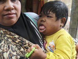 Jeritan Seorang Anak Disabilitas Masih dalam Gendongan Ibu