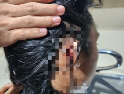 Pemilihan Ketua BEM Unimal Jadi Ricuh, Tiga Mahasiswa Jadi Korban