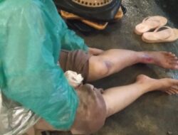 Korban Laka Tunggal Akibatkan Jalan Berlubang Terpaksa di Larikan ke Puskesmas