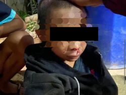 Sadis! Anak 13 Tahun Dianiaya Berat di Ketapang, Polisi Tangani Kasusnya
