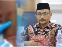 Sempat Ditolak Dua Rumah Sakit, Pemuda Korban Pembacokan di Pusong Lhokseumawe Mengadu Ke Haji Uma Beri Bantuan Medis